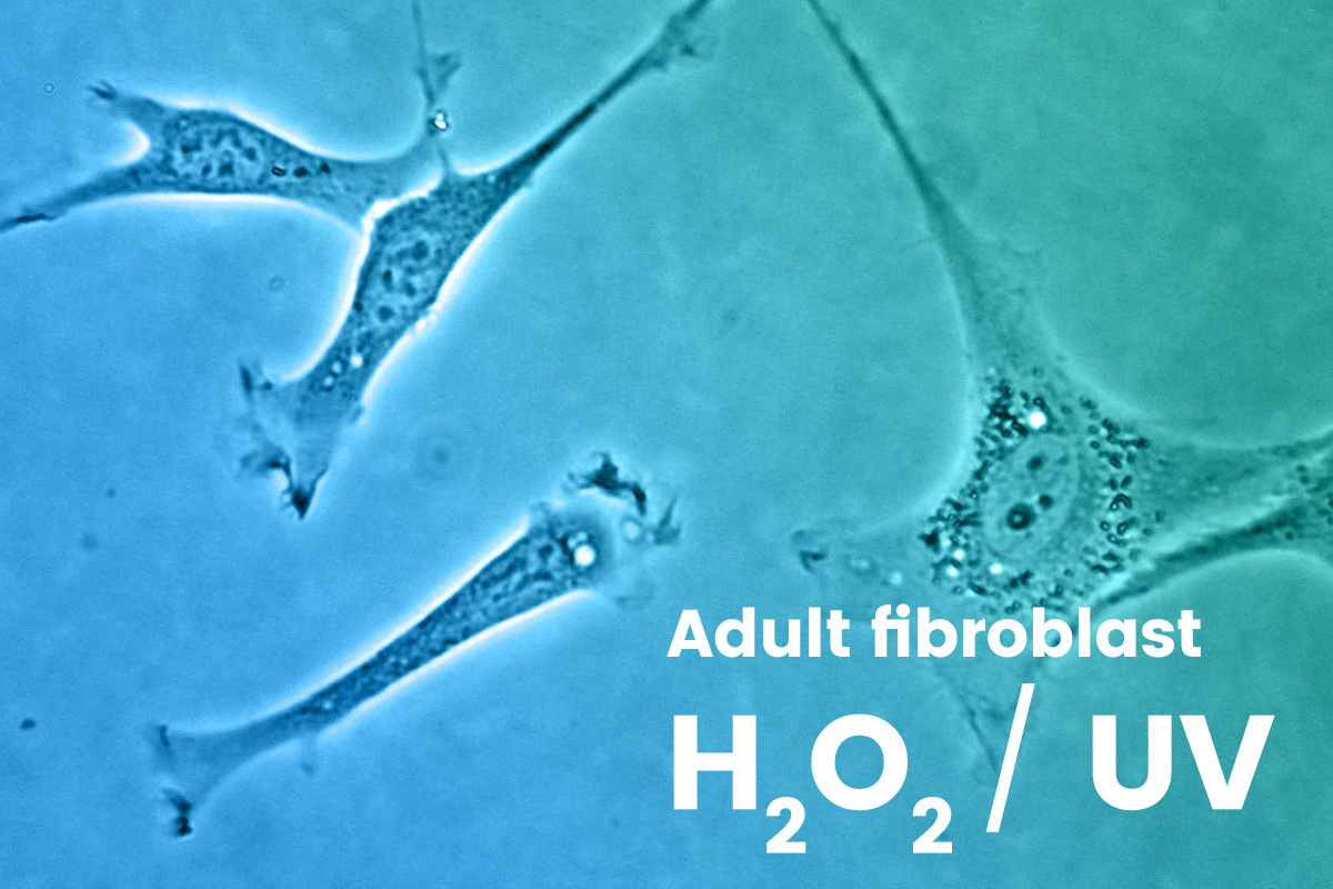 Adult fibroblast image