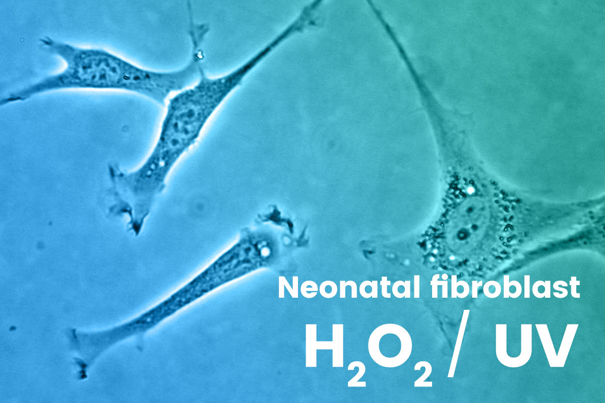 Neonatal fibroblast image